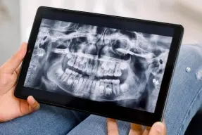 Dentist holding tablet displaying panoramic dental X-ray of patient teeth and jaw.